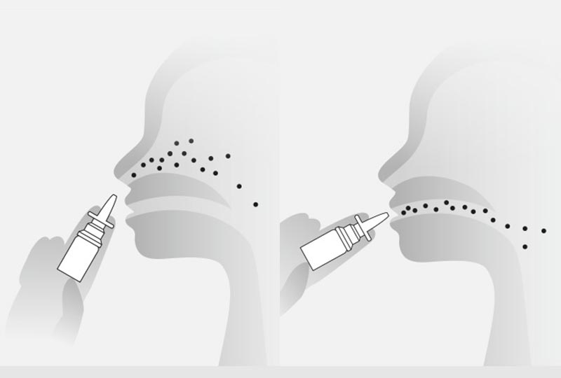 Grafik, die die Anwendung des Nasen- und Rachensprays zeigt