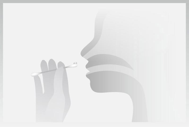 Grafik, die zeigt wie das RC-GEL NASAL Nasengel angewendet wird